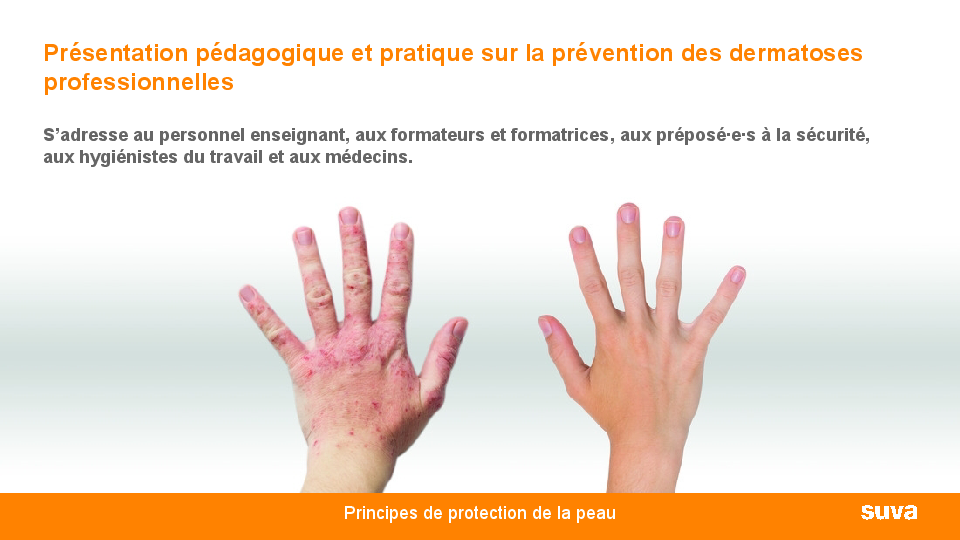 Éviter les allergies cutanées