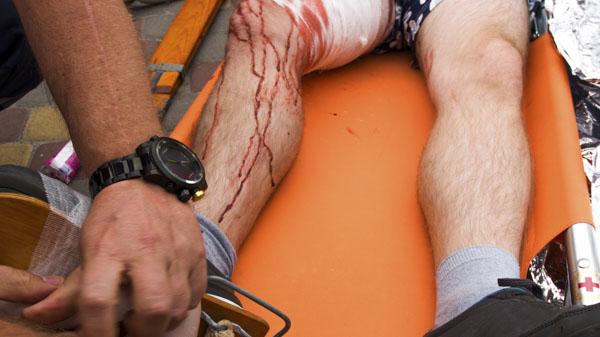 Image représentant un homme blessé à la jambe